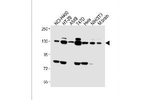 Image no. 4 for anti-Fibroblast Growth Factor Receptor 2 (FGFR2) (AA 794-821), (C-Term) antibody (ABIN391966)
