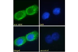 ABIN1019674 Immunofluorescence analysis of paraformaldehyde fixed A431 cells, permeabilized with 0.