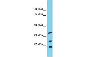 Image no. 1 for anti-Solute Carrier Family 25 (Mitochondrial Carrier, Peroxisomal Membrane Protein, 34kDa), Member 17 (SLC25A17) (N-Term) antibody (ABIN2791062)