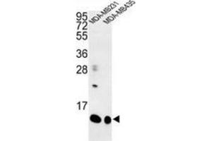 Image no. 1 for anti-Small Proline Rich Protein 1B (SPRR1B) (AA 60-89), (C-Term) antibody (ABIN954942)