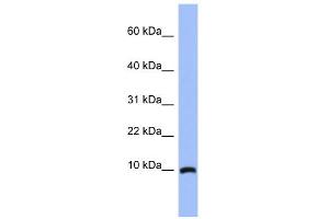 anti-Acyl-CoA Binding Domain Containing 7 (ACBD7) (N-Term) antibody