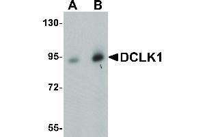 Image no. 1 for anti-Doublecortin-Like Kinase 1 (DCLK1) (N-Term) antibody (ABIN6656681)