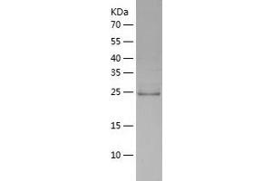 PLEKHF2 Protein (AA 1-249) (His tag)
