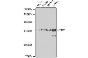 Image no. 2 for anti-Transcription Termination Factor, RNA Polymerase II (TTF2) antibody (ABIN6149675)