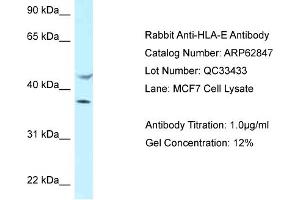Image no. 1 for anti-HLA Class I Histocompatibility Antigen, alpha Chain E (HLA-E) (C-Term) antibody (ABIN2789266)