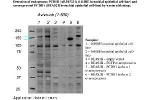 Image no. 2 for anti-Protocadherin 1 (PCDH1) (N-Term) antibody (ABIN2782181)