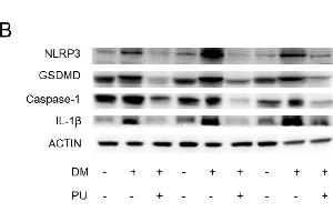 Image no. 1 for anti-Interleukin 1, beta (IL1B) antibody (ABIN3021462)