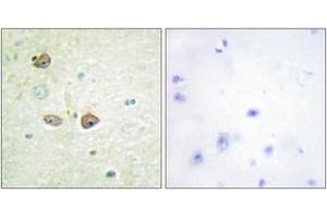 Image no. 1 for anti-Serotonin Receptor 1B (HTR1B) (AA 201-250) antibody (ABIN1534239)