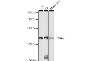 AP1B1 Antikörper  (AA 700-800)
