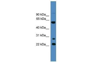 Image no. 1 for anti-Meiosis-Specific Nuclear Structural 1 (MNS1) (N-Term) antibody (ABIN928943)