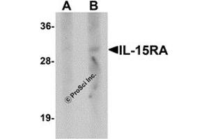 Image no. 1 for anti-Interleukin 15 Receptor, alpha (IL15RA) antibody (ABIN1077442)