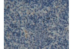 Image no. 2 for anti-ATP-Binding Cassette, Sub-Family B (MDR/TAP), Member 8 (ABCB8) (AA 468-714) antibody (ABIN5013187)