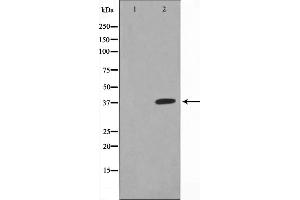 XRCC3 antibody  (N-Term)