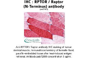 Image no. 1 for anti-Regulatory Associated Protein of mTOR, Complex 1 (RPTOR) antibody (ABIN1738960)
