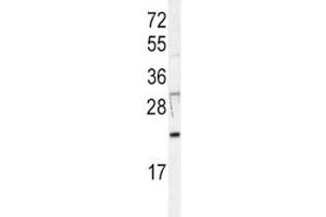 Image no. 3 for anti-HRas proto-oncogene, GTPase (HRAS) (AA 104-128) antibody (ABIN3029525)