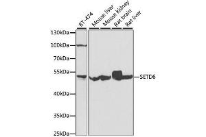 SETD6 antibody  (AA 301-473)