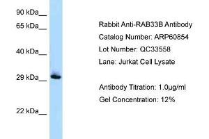 Western Blotting (WB) image for anti-RAB33B, Member RAS Oncogene Family (RAB33B) (Middle Region) antibody (ABIN2788609)