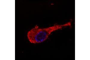 Image no. 1 for anti-Neurofilament Triplet M Protein (NEFM) antibody (ABIN94435)