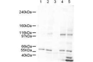 Western blot using  Affinity Purified anti-SmarcAL1 antibody shows detection of a band ~106 kDa band (arrowhead) corresponding to SmarcAL1 in human derived cultured cell lysates (HeLa nuclear extract lane 1, HeLa lane 2, A431 lane 3, Jurkat lane 4, and 293 lane 5).
