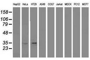 Image no. 1 for anti-Annexin A3 (ANXA3) antibody (ABIN1496643)