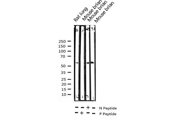anti-Checkpoint Kinase 2 (CHEK2) (pThr68) antibody