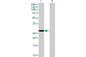 Image no. 2 for anti-Testis-Specific Serine Kinase 6 (TSSK6) (AA 1-273) antibody (ABIN529539)