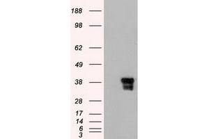 Image no. 1 for anti-DNA Fragmentation Factor, 45kDa, alpha Polypeptide (DFFA) (AA 1-331) antibody (ABIN2719431)