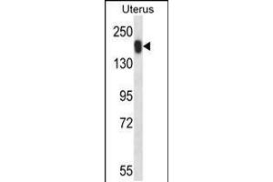 Image no. 1 for anti-Ubiquitin Specific Peptidase 43 (USP43) (AA 900-928), (C-Term) antibody (ABIN5534793)
