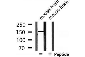 Image no. 1 for anti-Ubiquitin Specific Peptidase 42 (USP42) (Internal Region) antibody (ABIN6258563)
