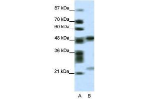 Image no. 1 for anti-PHD Finger Protein 11 (PHF11) (Middle Region) antibody (ABIN927514)