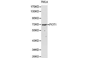 Image no. 1 for anti-Protection of Telomeres 1 (POT1) antibody (ABIN5663924)