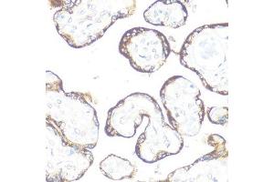 Image no. 1 for anti-Fibroblast Growth Factor Receptor 2 (FGFR2) antibody (ABIN3022855)