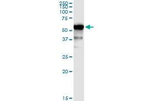 Image no. 1 for anti-UDP Glucuronosyltransferase 1 Family, Polypeptide A9 (UGT1A9) (AA 1-530) antibody (ABIN949373)