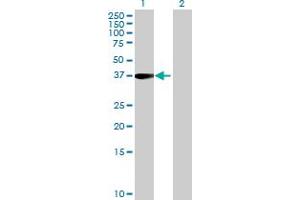 Image no. 1 for anti-T-Cell Leukemia Homeobox 3 (TLX3) (AA 1-291) antibody (ABIN526236)