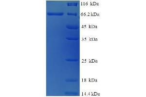 Image no. 1 for Cysteine Conjugate-beta Lyase 2 (CCBL2) (AA 1-454), (full length) protein (His-SUMO Tag) (ABIN5711433)