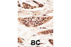 Image no. 1 for anti-Transporter 1, ATP-Binding Cassette, Sub-Family B (MDR/TAP) (TAP1) (AA 765-794), (C-Term) antibody (ABIN390185)