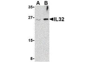 Image no. 1 for anti-Interleukin 32 (IL32) (Center) antibody (ABIN2475003)