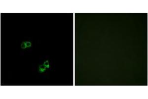 Image no. 2 for anti-Melanocortin 5 Receptor (MC5R) (AA 271-320) antibody (ABIN1535770)