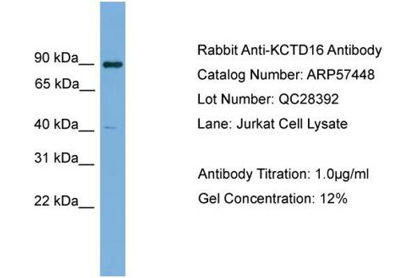 KCTD16 Antikörper  (N-Term)