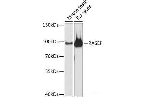 RASEF anticorps