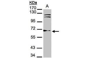 Image no. 4 for anti-Thioredoxin Reductase 1 (TXNRD1) (Center) antibody (ABIN2855577)