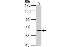 Image no. 1 for anti-Galactosamine (N-Acetyl)-6-Sulfate Sulfatase (GALNS) (Center) antibody (ABIN2856743)