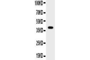 Image no. 1 for anti-Cathepsin B (CTSB) (AA 80-333) antibody (ABIN3042773)