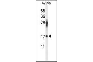 Image no. 1 for anti-Ribosomal Protein S11 (RPS11) (AA 87-116), (Middle Region) antibody (ABIN954610)