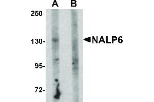 Image no. 1 for anti-NLR Family, Pyrin Domain Containing 6 (NLRP6) (N-Term) antibody (ABIN6655207)