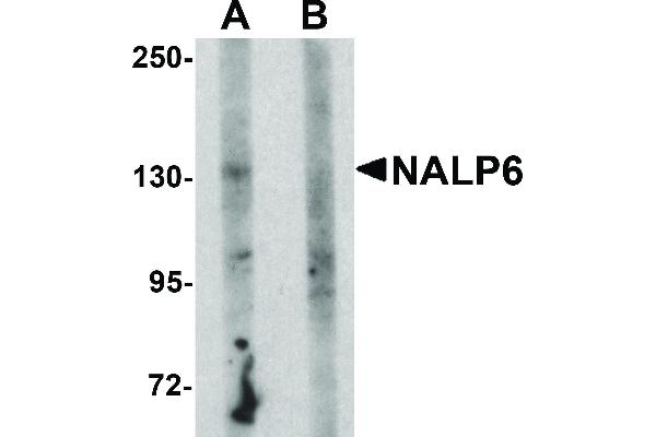 anti-NLR Family, Pyrin Domain Containing 6 (NLRP6) (N-Term) antibody
