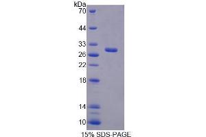 Image no. 1 for Replication Factor C (Activator 1) 4, 37kDa (RFC4) protein (ABIN6119535)
