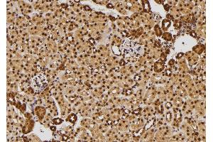 Image no. 4 for anti-Linker For Activation of T Cells (LAT) (pTyr45) antibody (ABIN6269667)