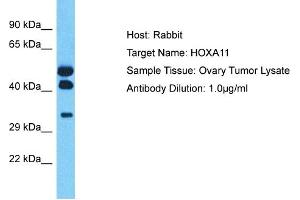 Host: Rabbit Target Name: HOXA11 Sample Type: Ovary Tumor lysates Antibody Dilution: 1.