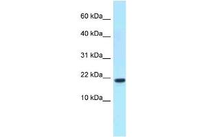 anti-X Antigen Family, Member 1D (XAGE1D) (C-Term) antibody